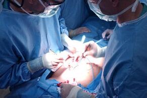 Melakukan operasi untuk meningkatkan penis