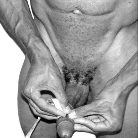 pengukuran penis sebelum pembesaran